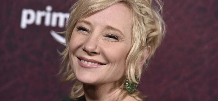 Anne Heche in critical condition